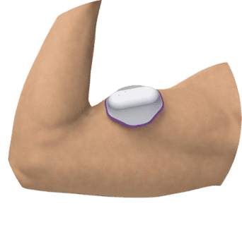 arm
